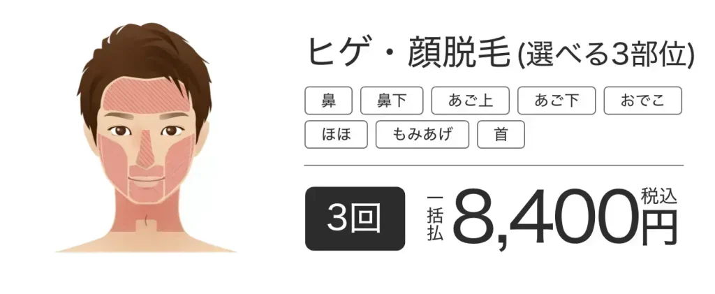 メンズエミナルの医療ヒゲ・顔脱毛選べる3部位3回プラン